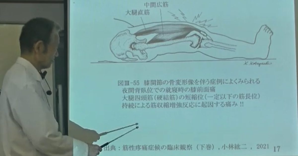 筋性疼痛症候の臨床観察: 筋の“運動作用”及び“感覚作用”視点からの見解 (上巻) Amazon.co.jp: 筋性疼痛症候の臨床観察: 筋の“運動作用”及び